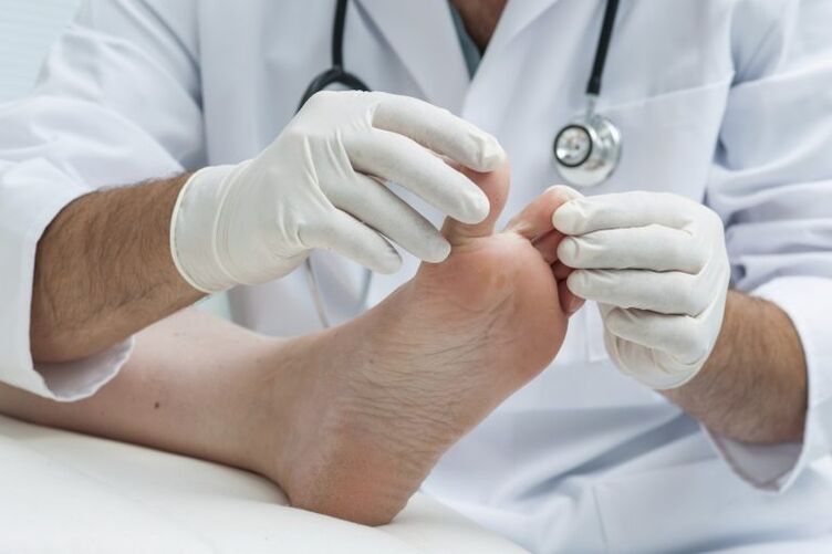 Mikoz varlığı ile doktor muayenesi