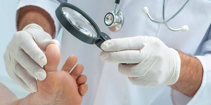 doktor ayak parmakları arasında mantar olup olmadığını inceliyor